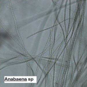 Anabaena sp
